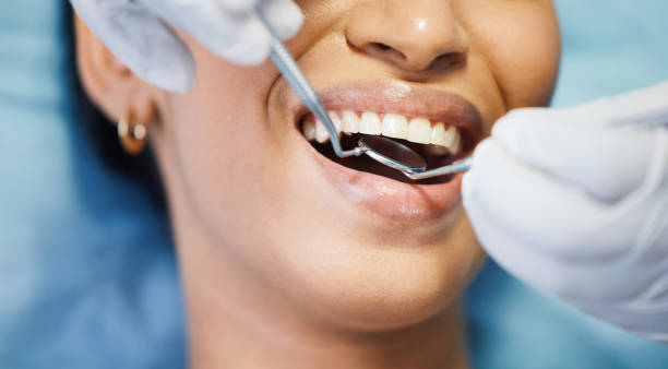 Best Weekend Emergency Dental Services in Lemoore Station, CA